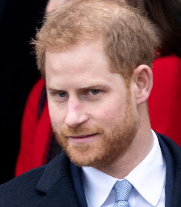 Is Prince Harry wearing hair loss CONCEALER? Hair Expert warns Prince will be almost BALD in two years