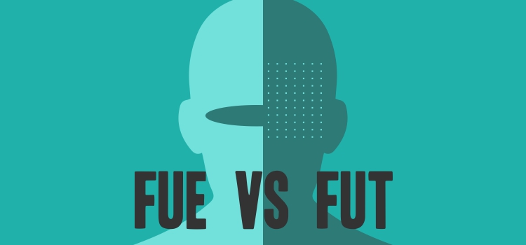 FUE vs FUT hair transplant