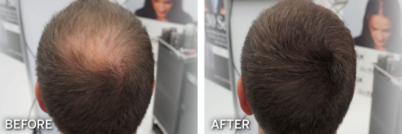 Biothik Hair Fibres - Before and After - Men