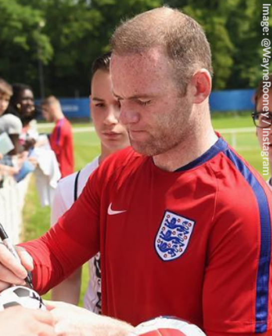 Is Wayne Rooney using Hair Loss Concealers? | BioTHIK